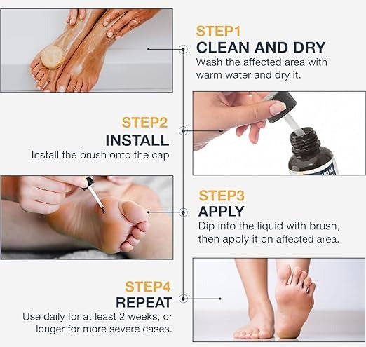BEE VENOM WART REMOVER