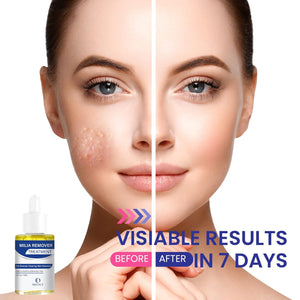 Milia Remover Treatment serum: Milia Spot Treatment with Salicylic Acid Milia Ac image 1