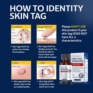 Fast-Acting Skin Tag Remover: Skin Tag Remover with Salicylic Acid image 4
