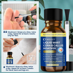Fast-Acting Wart Remover Freeze Off image 3