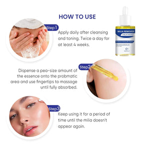 Milia Remover Treatment serum: Milia Spot Treatment with Salicylic Acid Milia Ac image 2