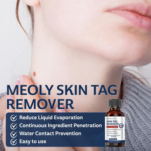 Fast-Acting Skin Tag Remover: Skin Tag Remover with Salicylic Acid image 3